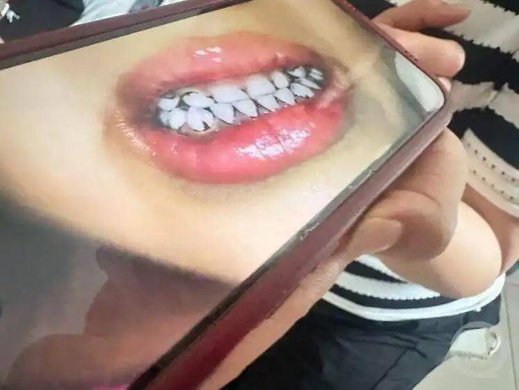 中国甘肃省天水市幼儿园有233名学童血铅浓度异常，竟是园长、投资人指示以颜料制作餐点酿祸。（图撷自微博）