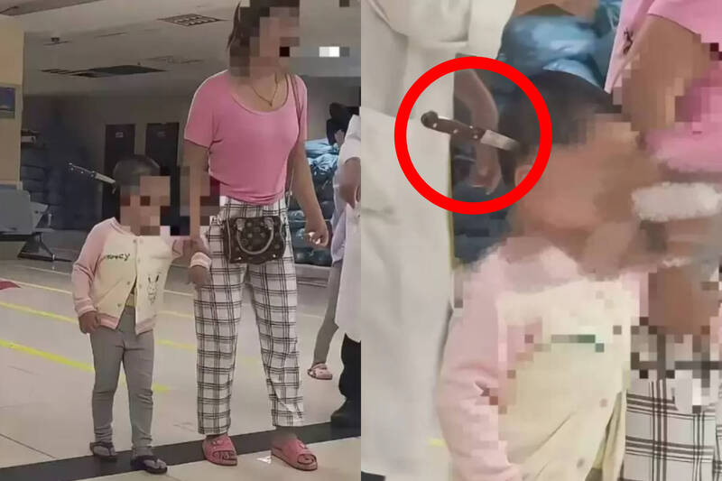 中国云南一名3岁女童头上竟插著一把水果刀。（本报合成，撷取自微博）